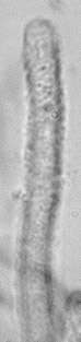 Image of Lachnellula occidentalis (G. G. Hahn & Ayers) Dharne 1965