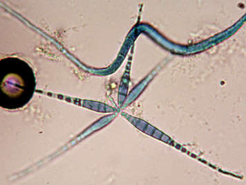 Image of Flabellospora