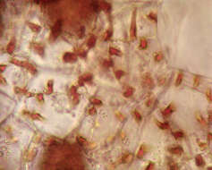 Image of <i>Fossombronia <i>pusilla</i></i> subsp. pusilla