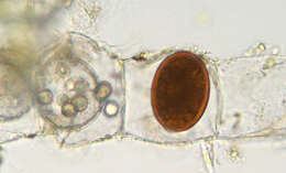 Spirogyra majuscula resmi