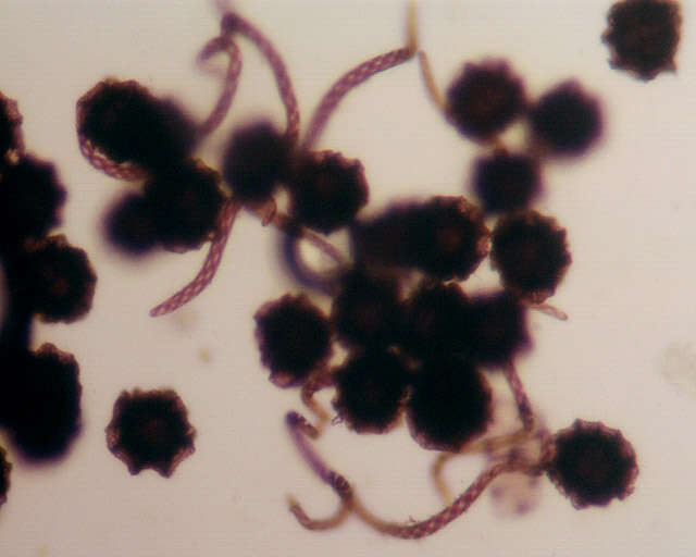 Image of Targioniaceae