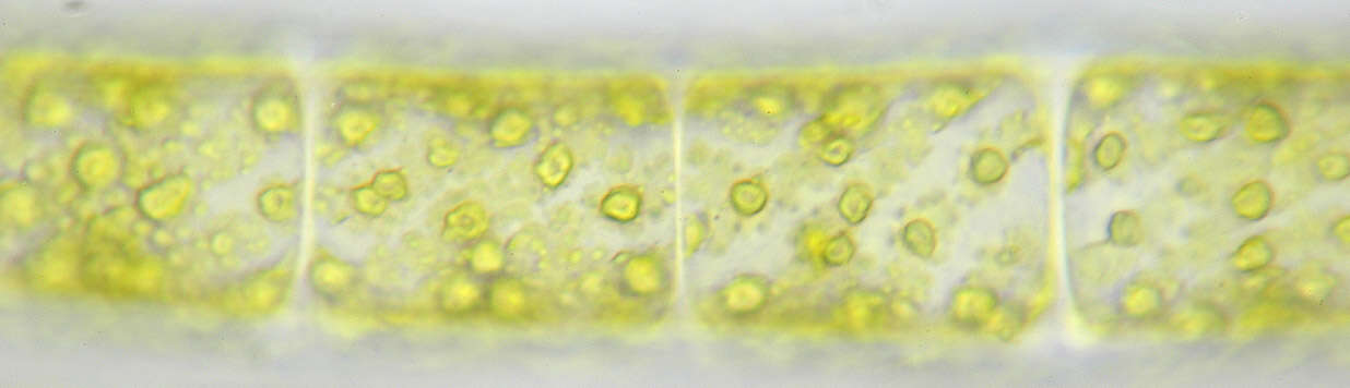 Spirogyra majuscula resmi