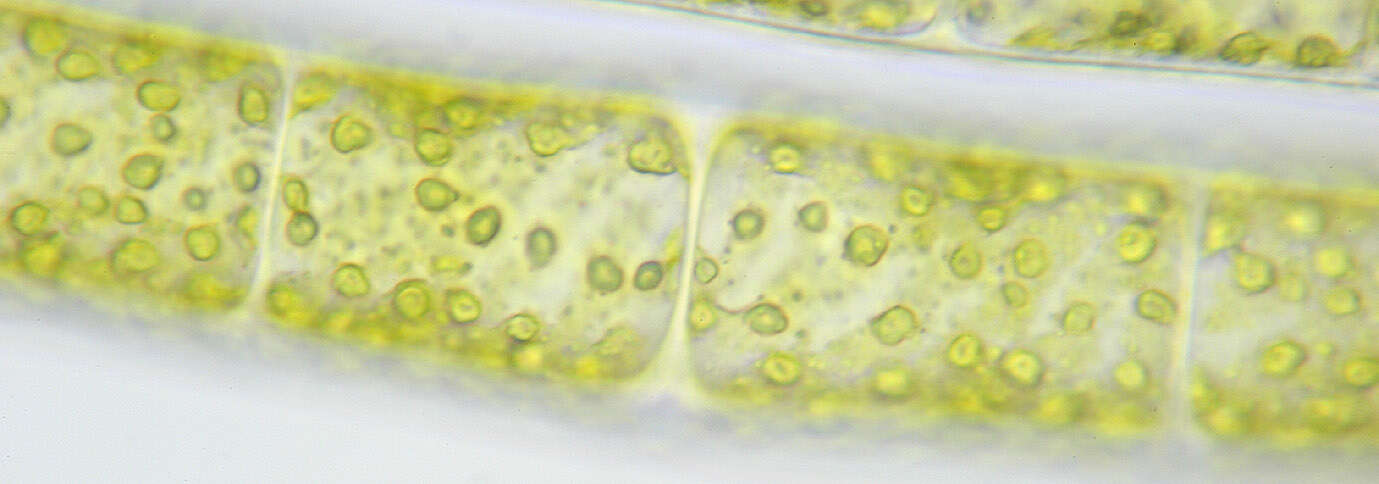 Spirogyra majuscula resmi