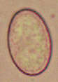 Image of Scutellinia scutellata (L.) Lambotte 1887