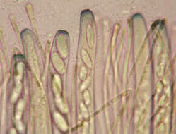 Image of Pachyella violaceonigra (Rehm) Pfister 1974