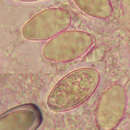 Image of Pachyella violaceonigra (Rehm) Pfister 1974