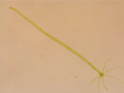 Image of Hydra viridissima Pallas 1766