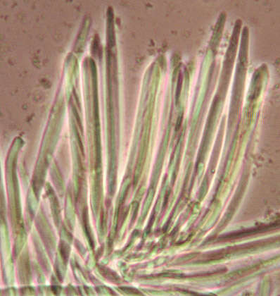 Plancia ëd Belonidium mollissimum (Fuckel) Raitv. 1970