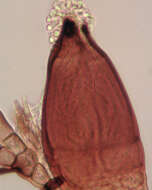 Image of Laboulbenia cristata Thaxt. 1892