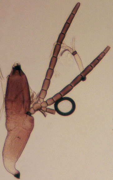 Image of Laboulbenia cristata Thaxt. 1892