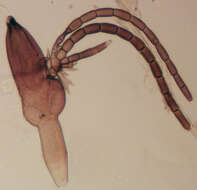 Image of Laboulbenia cristata Thaxt. 1892