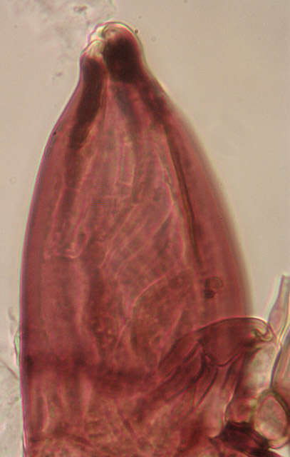 Image of Laboulbenia cristata Thaxt. 1892