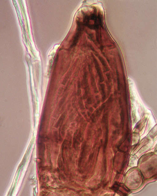 Слика од Laboulbenia cristata Thaxt. 1892