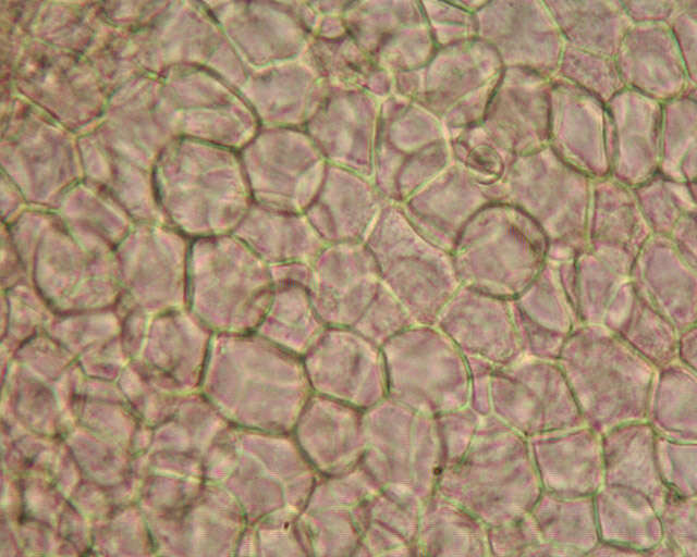 Image de Ascobolus albidus P. Crouan & H. Crouan 1858