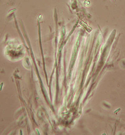 Image de Chlorociboria aeruginascens (Nyl.) Kanouse ex C. S. Ramamurthi, Korf & L. R. Batra 1958