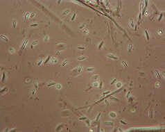 Image of Chlorociboria aeruginascens (Nyl.) Kanouse ex C. S. Ramamurthi, Korf & L. R. Batra 1958