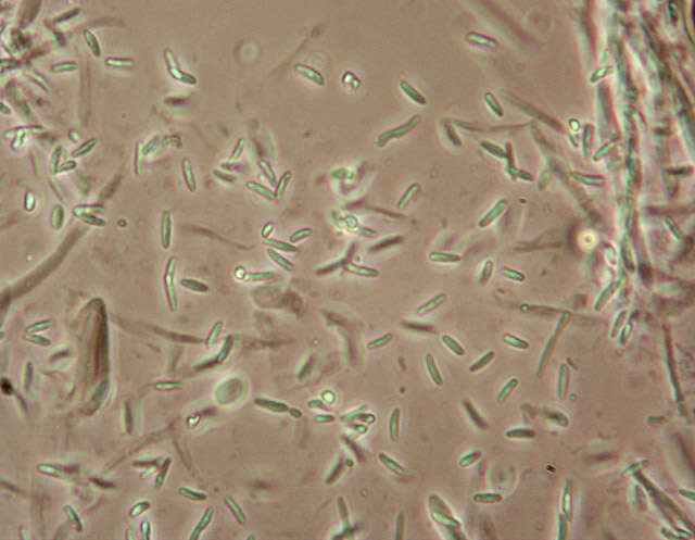 Image de Chlorociboria aeruginascens (Nyl.) Kanouse ex C. S. Ramamurthi, Korf & L. R. Batra 1958