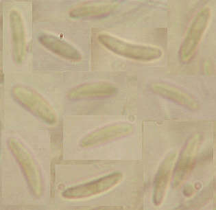 Image de Chlorociboria aeruginascens (Nyl.) Kanouse ex C. S. Ramamurthi, Korf & L. R. Batra 1958