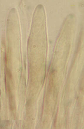 Image of Chlorociboria aeruginascens (Nyl.) Kanouse ex C. S. Ramamurthi, Korf & L. R. Batra 1958