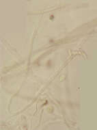 Image of Chlorociboria aeruginascens (Nyl.) Kanouse ex C. S. Ramamurthi, Korf & L. R. Batra 1958