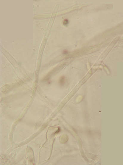 Image of Chlorociboria aeruginascens (Nyl.) Kanouse ex C. S. Ramamurthi, Korf & L. R. Batra 1958