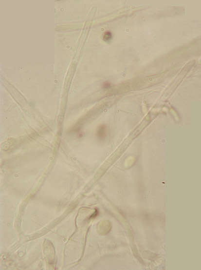 Image de Chlorociboria aeruginascens (Nyl.) Kanouse ex C. S. Ramamurthi, Korf & L. R. Batra 1958