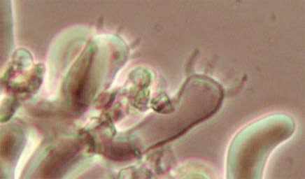 Image de Botryobasidium candicans J. Erikss. 1958