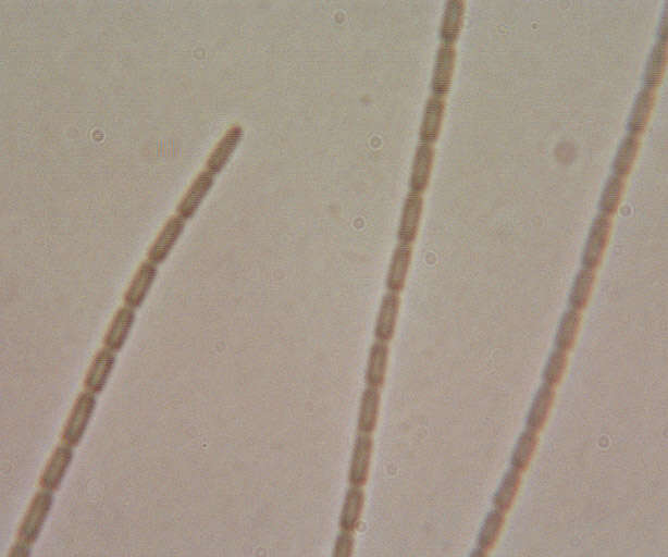 Cordyceps militaris (L.) Fr. 1818 resmi