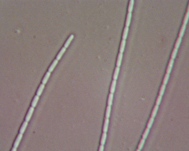 Cordyceps militaris (L.) Fr. 1818 resmi