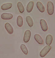 Image de Amylostereum laevigatum (Fr.) Boidin 1958