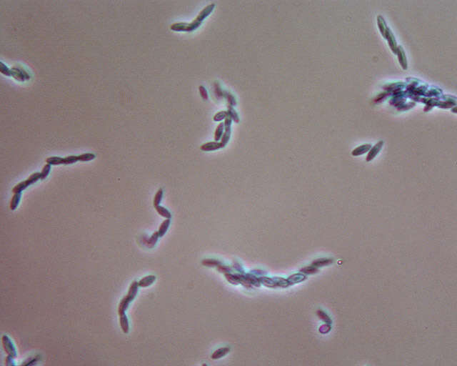 Image of Clonostachys buxi (J. C. Schmidt ex Link) Schroers 2001