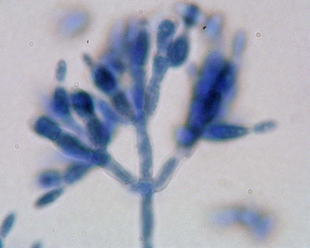 Image of Clonostachys buxi (J. C. Schmidt ex Link) Schroers 2001