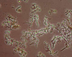 Image of needle lichen