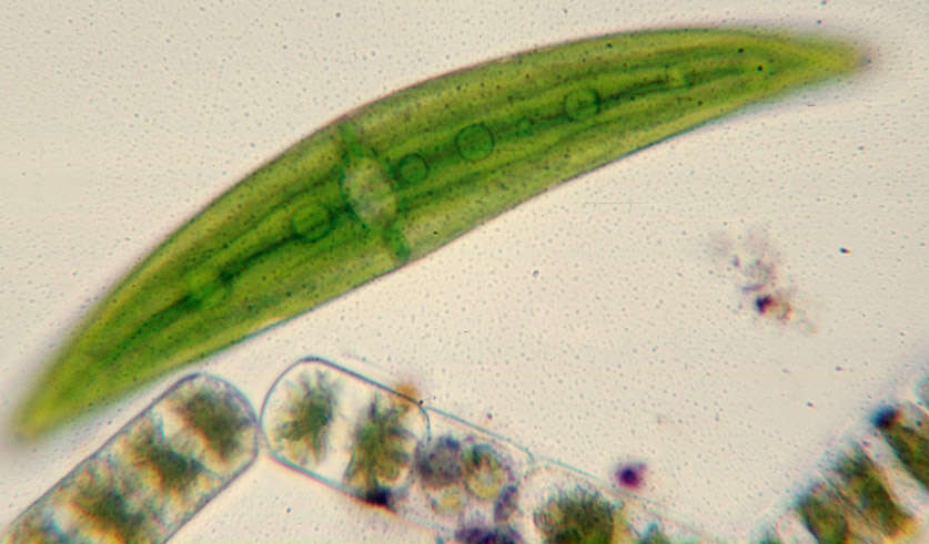 Image of Closterium moniliferum