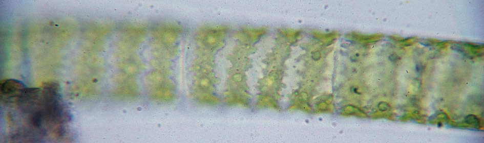 Image of Spirogyra Link 1820