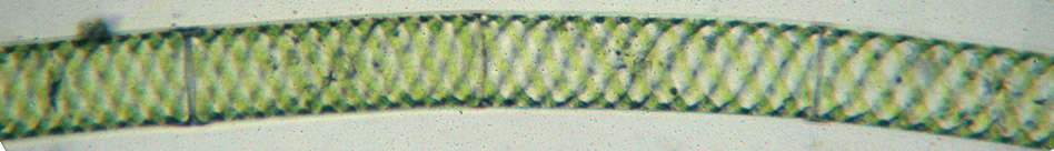 Image of Spirogyra Link 1820