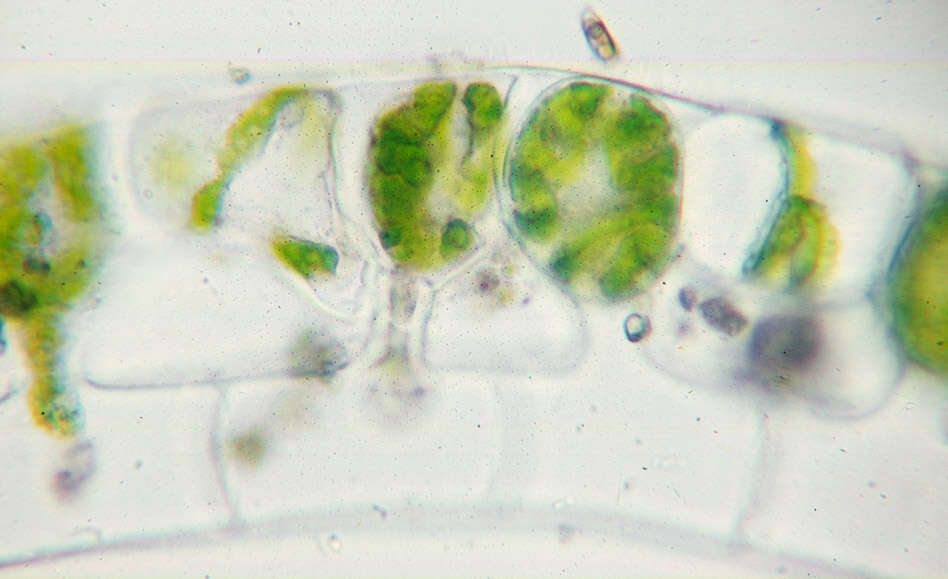 Image of Spirogyra Link 1820