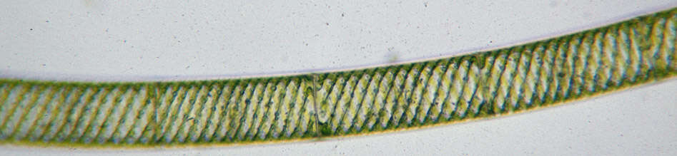 Image of Spirogyra Link 1820