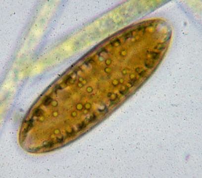 Image of Surirella biseriata