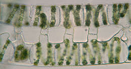 Image of Spirogyra Link 1820