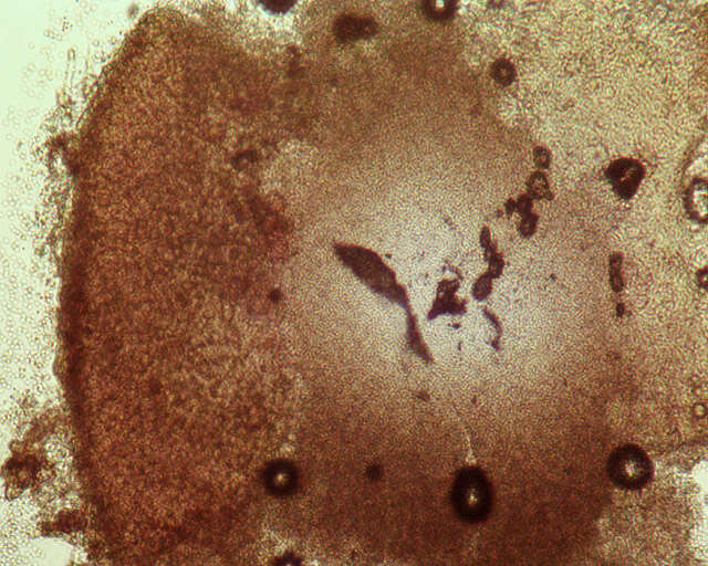 Image of resin sarea lichen