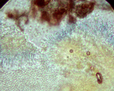 Image of resin sarea lichen