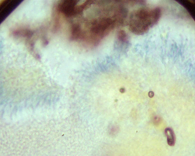 Image of resin sarea lichen