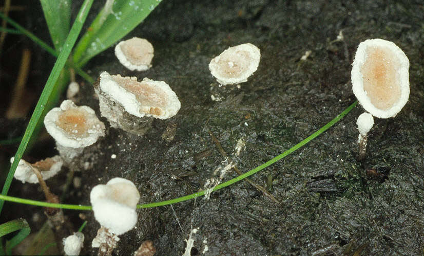 Image of Nail fungus