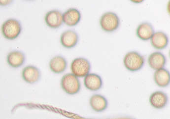 Image of Trichia botrytis