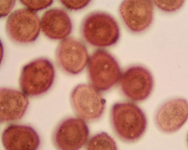 Puccinia hieracii (Röhl.) H. Mart. 1817的圖片