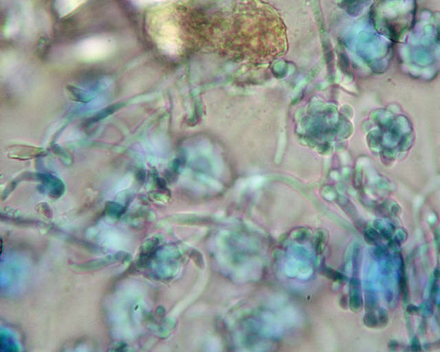 Image de Hypomyces papulasporae Rogerson & Samuels 1985