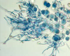 Image of Hypomyces papulasporae Rogerson & Samuels 1985