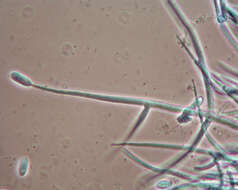 Image of Hypomyces papulasporae Rogerson & Samuels 1985