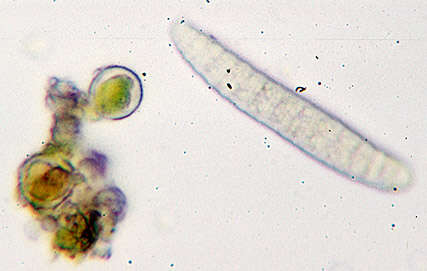 Sivun Graphis elegans (Borrer ex Sm.) Ach. kuva